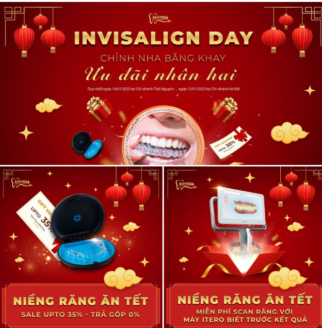 CHỈNH NHA BẰNG KHAY - ƯU ĐÃI NHÂN HAI