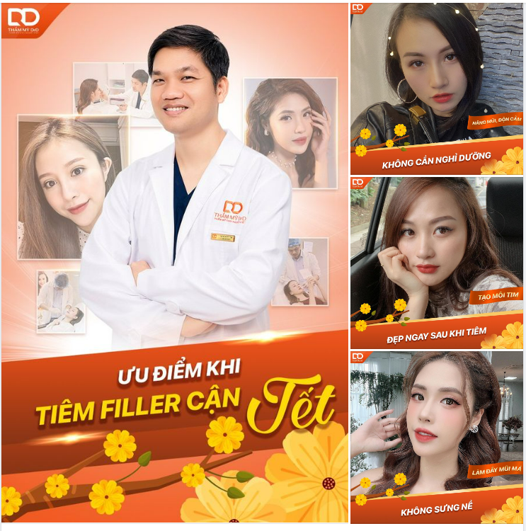 NHỮNG ƯU ĐIỂM KHI CHỌN TIÊM FILLER CẬN TẾT