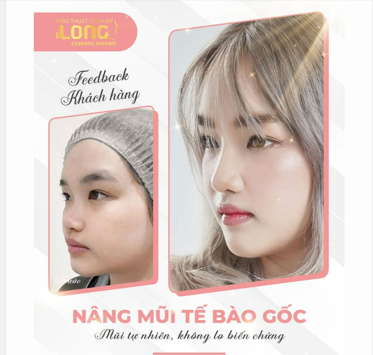 GEN Z KHI CHỌN NÂNG MŨI PHẢI ĐẦY ĐỦ CÁC TIÊU CHÍ NÀO?GEN Z KHI CHỌN NÂNG MŨI PHẢI ĐẦY ĐỦ CÁC TIÊU CHÍ NÀO?