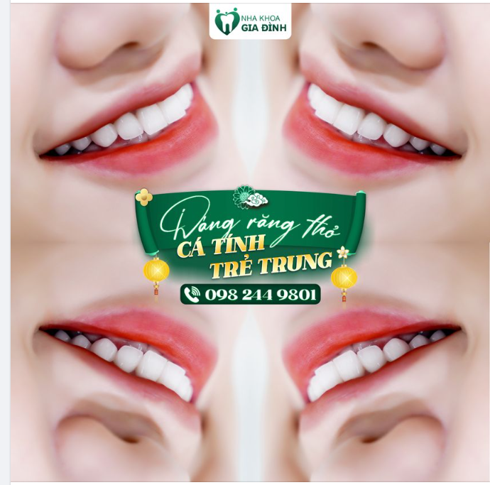 LỰA CHỌN DÁNG RĂNG THỎ TRẺ TRUNG THỂ HIỆN CÁ TÍNH