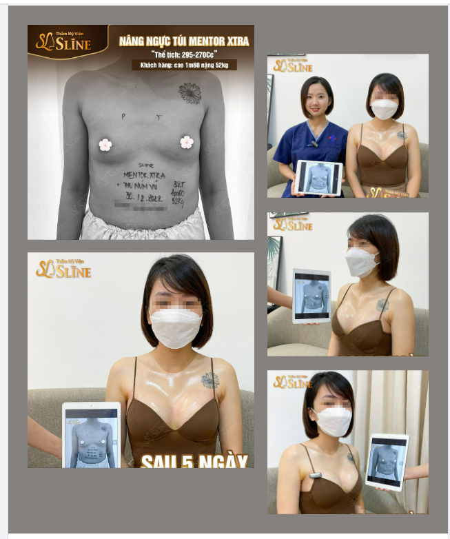 “Tết này phải khác Tết xưa. Phải tiền đầy túi, ngực xinh trên mình”.