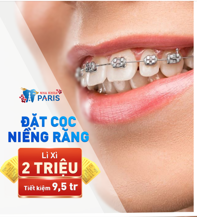 Niềng Răng Đón Thần Tài