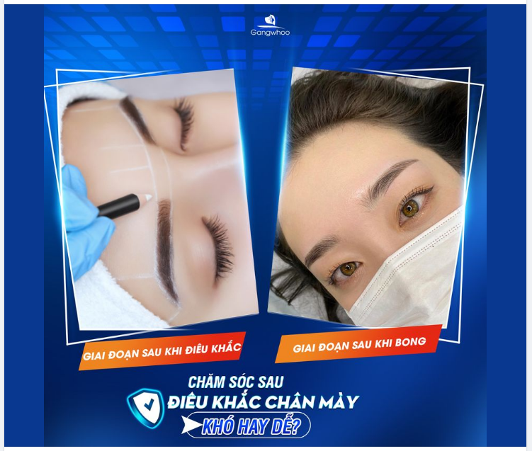 SAU KHI ĐIÊU KHẮC CHÂN MÀY - LÀM GÌ ĐỂ CHÂN MÀY MAU ĐẸP