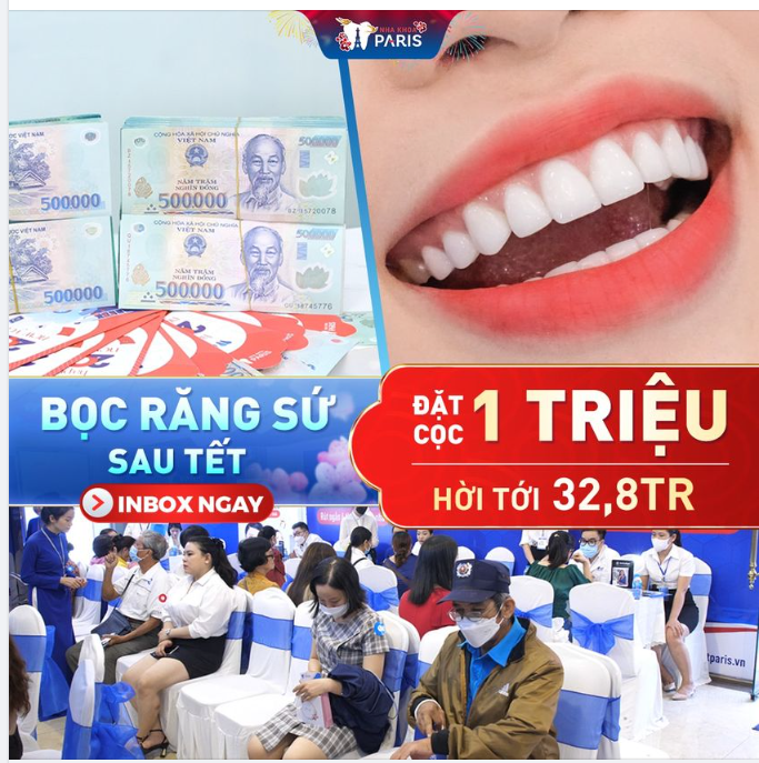 Bọc Răng Sứ Sau Tết - Nhận Giá Siêu Hời