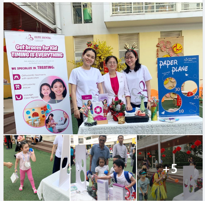 Không phải chỉ mới bắt đầu 1-2 năm, điều trị chỉnh nha/niềng răng trẻ em là điều trị ”signature” tại Elite với 11 năm kinh nghiệm.