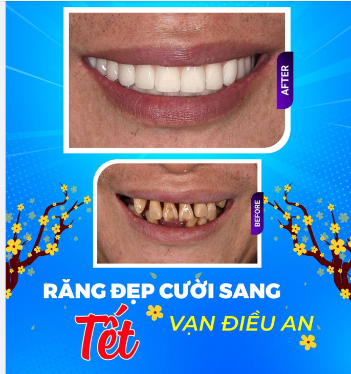 RĂNG ĐẸP CƯỜI SANG - TẾT VẠN ĐIỀU AN