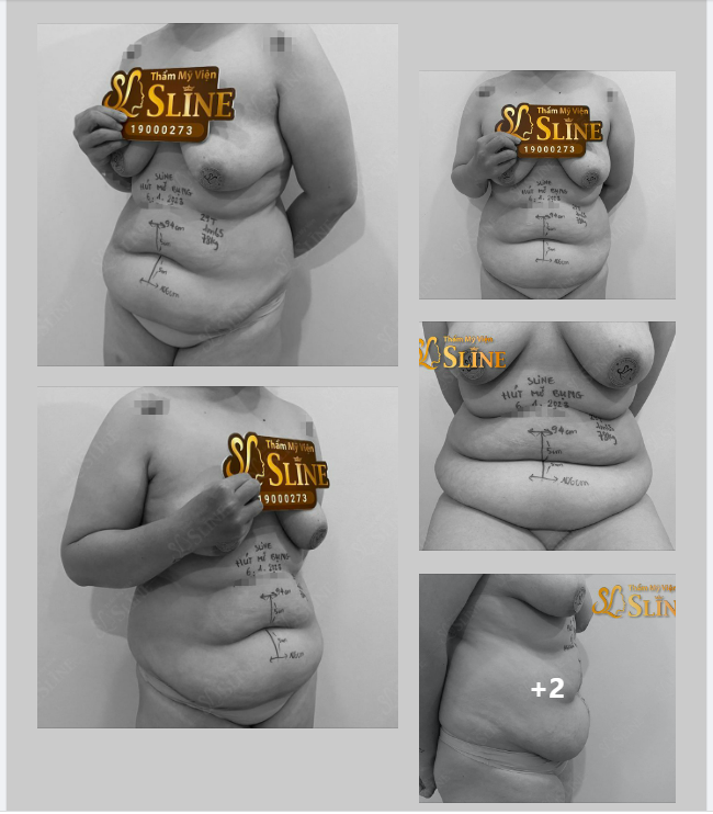 BODY CỦA BẠN NỮ CHƯA LẬP GIA ĐÌNH VÀ...