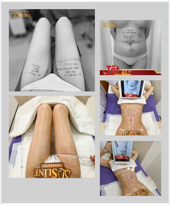 UPDATE BODY SIÊU PHẨM SAU 24H THỰC HIỆN.