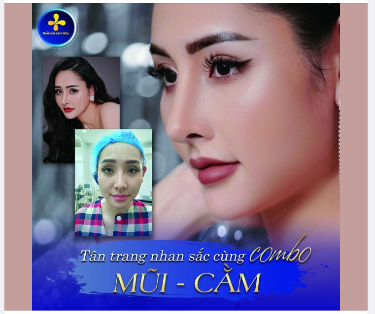 “Combo hoàn hảo” Nâng mũi + Độn cằm đã thay đổi hoàn toàn diện mạo lẫn thần thái của khách hàng.