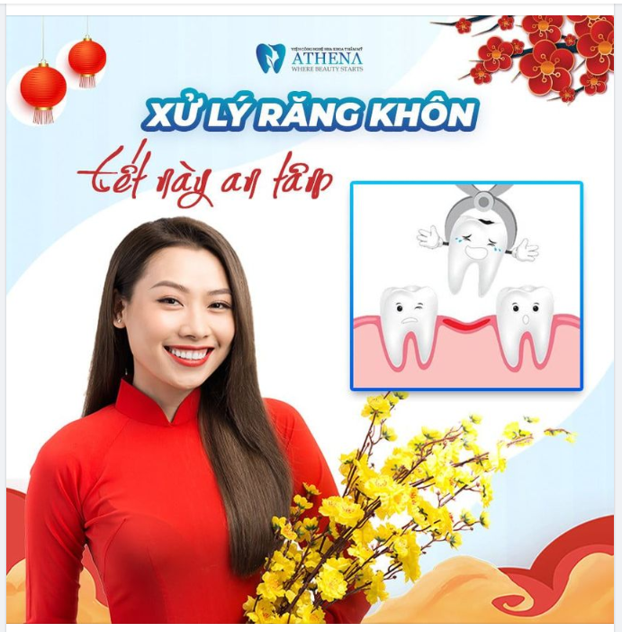 DẸP BỎ RĂNG KHÔN - TẾT NÀY THÊM AN TÂM!!!!