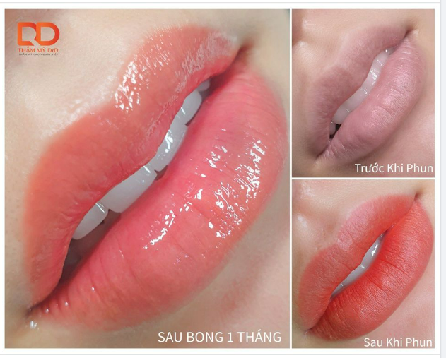 PHUN MÔI COLLAGEN - ĐẸP HOÀN HẢO MỌI GÓC NHÌN