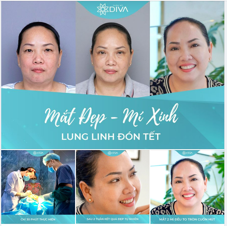 MẮT ĐẸP MÍ XINH – LUNG LINH ĐÓN TẾT