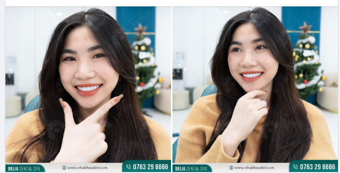 Mình là người khá sợ đau, nhất là khi phải đối với ghế nha.