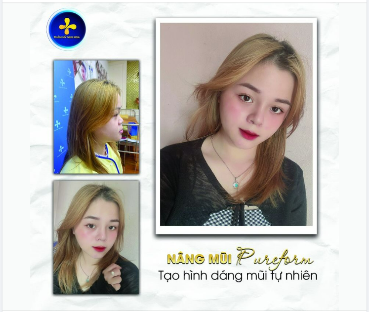 PHẪU THUẬT THẨM MỸ MŨI không chỉ giúp bạn thay đổi nhan sắc mà còn là phương pháp giúp bạn tự tin hơn trong công việc, cuộc sống.