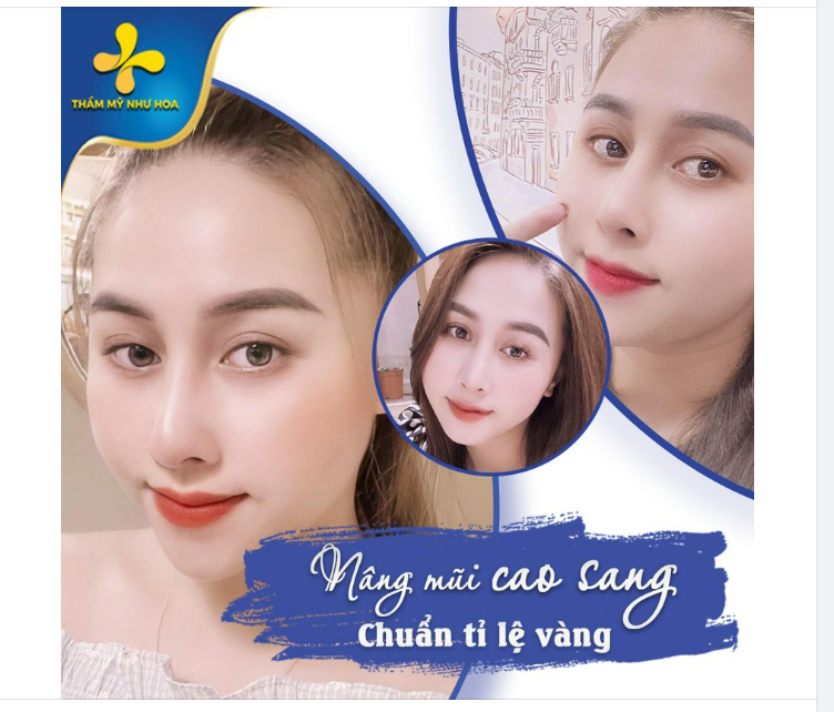NGŨ QUAN THÊM HÀI HÒA - NHAN SẮC THÊM RẠNG RỠ NHỜ DÁNG MŨI GOLDEN LINE