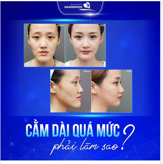 CẰM DÀI QUÁ MỨC ​​​​​​​ PHẢI LÀM SAO