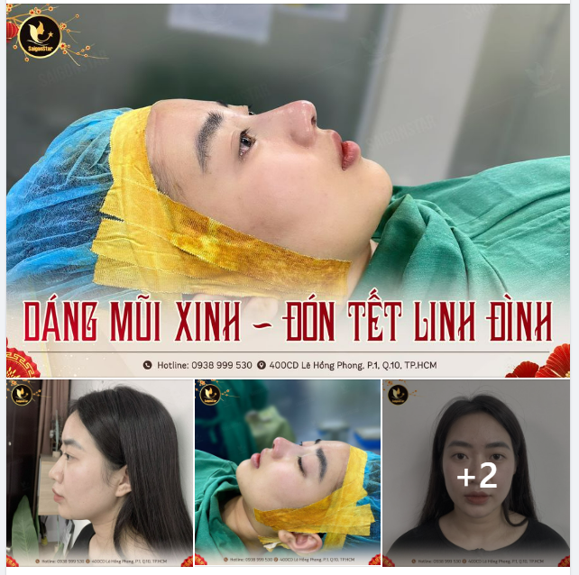 DÁNG MŨI XINH – ĐÓN TẾT LINH ĐÌNH
