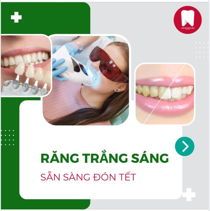 RĂNG TRẮNG SÁNG, SẴN SÀNG ĐÓN TẾT