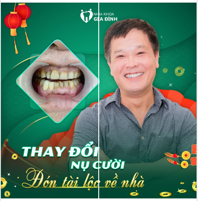 NĂM MỚI CƯỜI NHIỀU - GẶP NHIỀU MAY MẮN