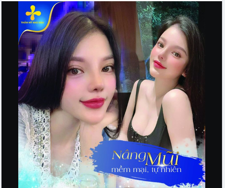 NHAN SẮC THĂNG HẠNG SAU KHI NÂNG MŨI SỤN MỸ