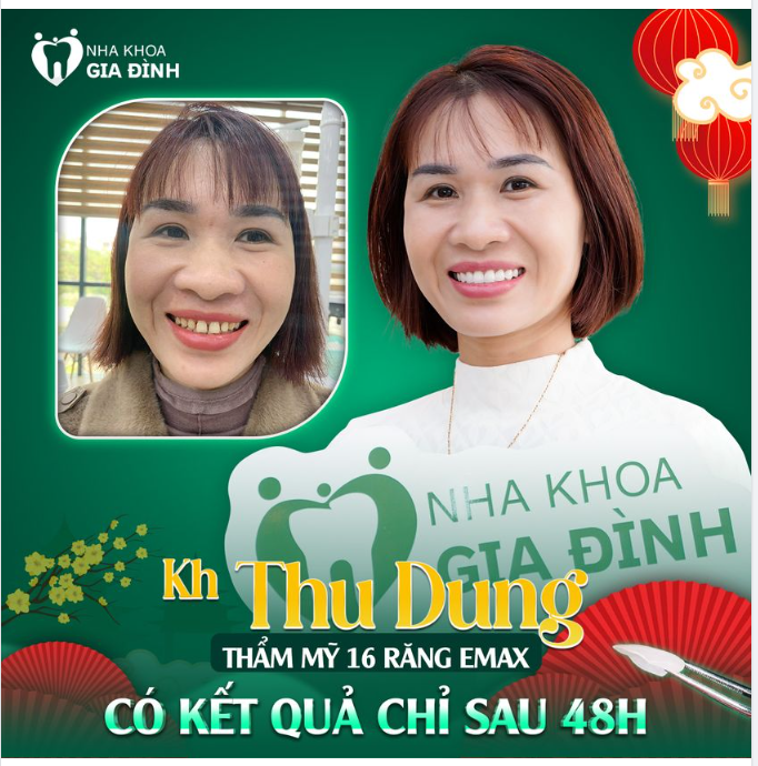 BẠN ĐÃ TỪNG TỰ TI KHI RĂNG QUÁ VÀNG, THƯA, DÁNG RĂNG QUÁ THÔ CHƯA?