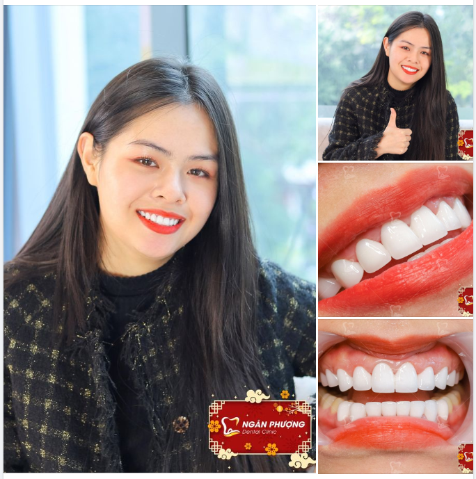 Tái khám mà sứ cứ đẹp xinh như thế này có làm tim rung rinh không chứ?