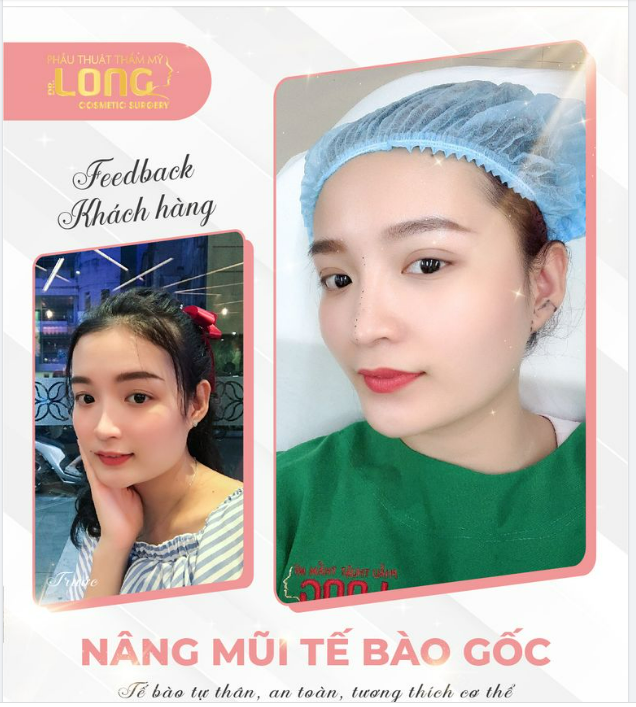 NÂNG MŨI CẬN TẾT - MŨI ĐẸP NGAY SAU KHI NÂNG