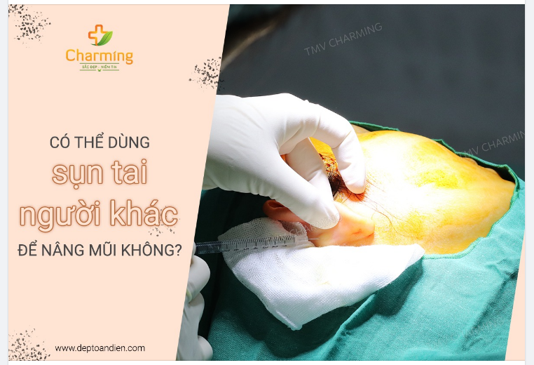 CÓ THỂ DÙNG SỤN TAI CỦA NGƯỜI KHÁC ĐỂ NÂNG MŨI KHÔNG?