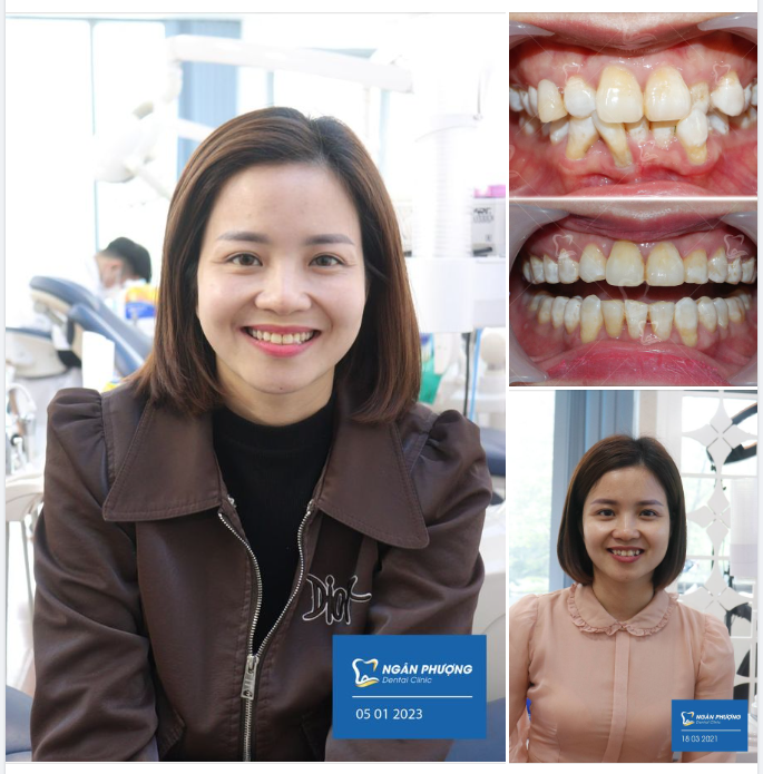 Làm gì thì làm, cứ răng đẹp xinh là Tết tươi cười hạnh phúc
