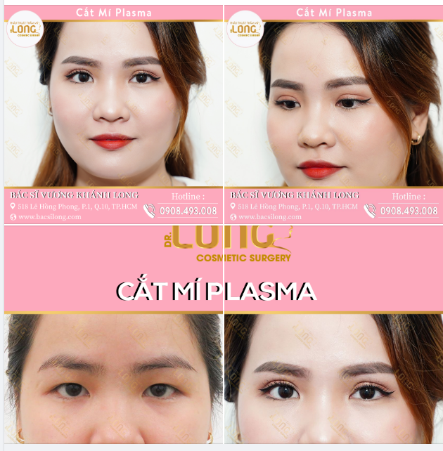 CỰC PHẨM MẮT XINH “ĐỐN TIM” BAO NGƯỜI