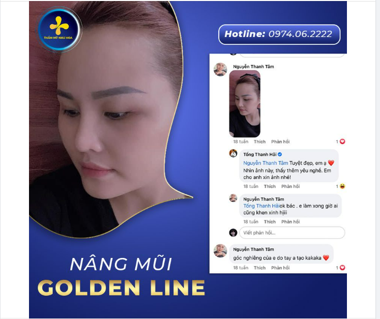 ”GÓC NGHIÊNG CỦA EM DO BÁC SĨ TỐNG HẢI TẠO”