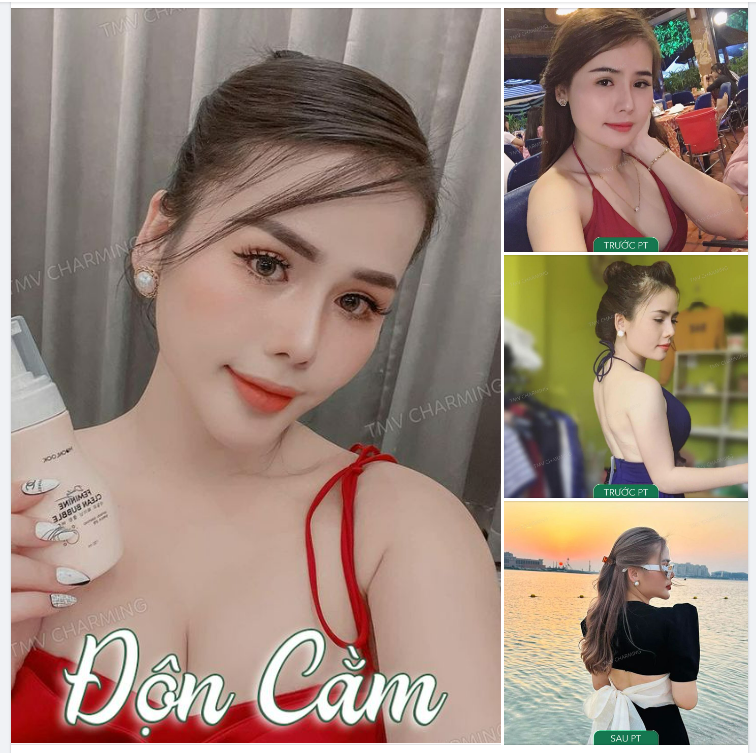 Năm mới năm mẻ, Charming khoe liền một chiếc feedback độn cằm đã được 7 tháng của nàng khách đây để chị em có thêm động lực làm đẹp nà
