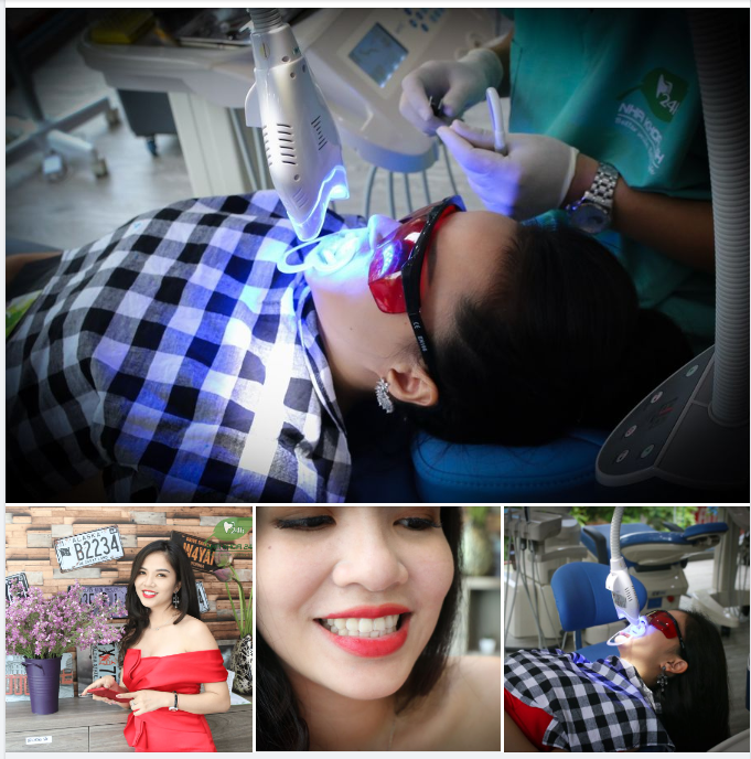 TẨY TRẮNG RĂNG ĐÓN TẾT VÓI CHỈ 1 TRIỆU ĐỒNG