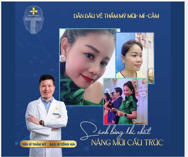 Dáng mũi Cấu Trúc đem lại sự tự tin – Sáng bừng khí chất cho nàng MC Thu Thảo. Sau nâng dáng mũi cao thẳng, đầu mũi cao bay hoàn hảo.