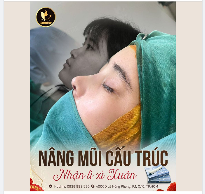 NÂNG MŨI CẤU TRÚC – NHẬN LÌ XÌ XUÂN