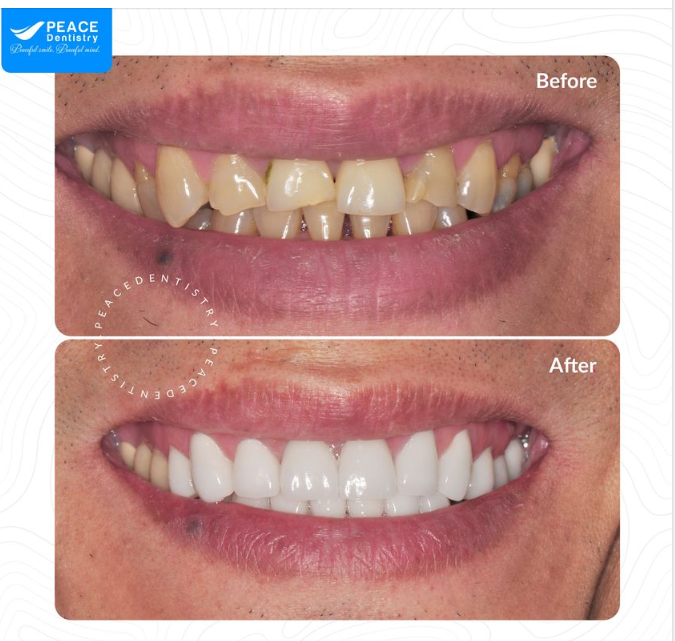 7 NGÀY CHO NỤ CƯỜI ĐẸP CUỐN HÚT