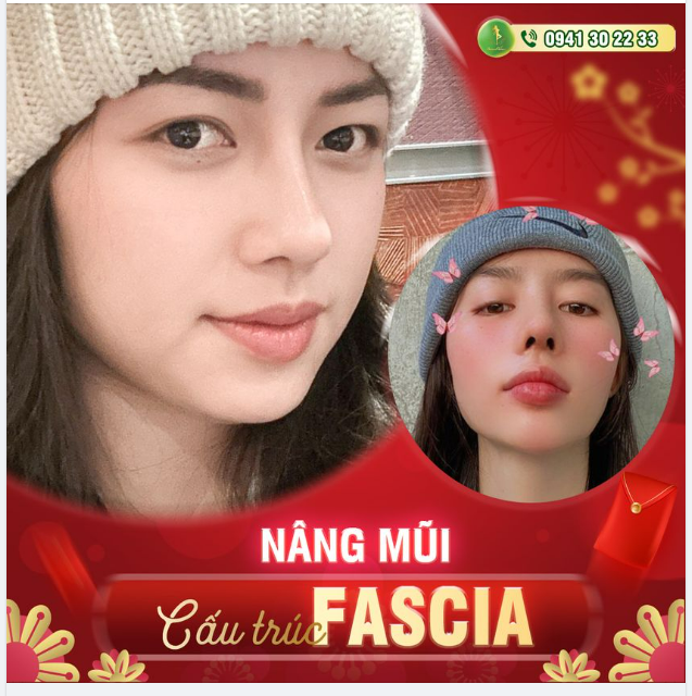 MŨI ĐẸP KỊP TẾT - SALE HẾT THẢ GA