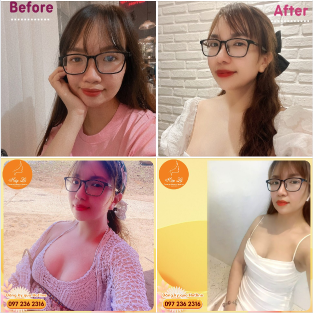 COMBO LÊN HƯƠNG NHAN SẮC - ĐẸP KHÔNG TÌ VẾT