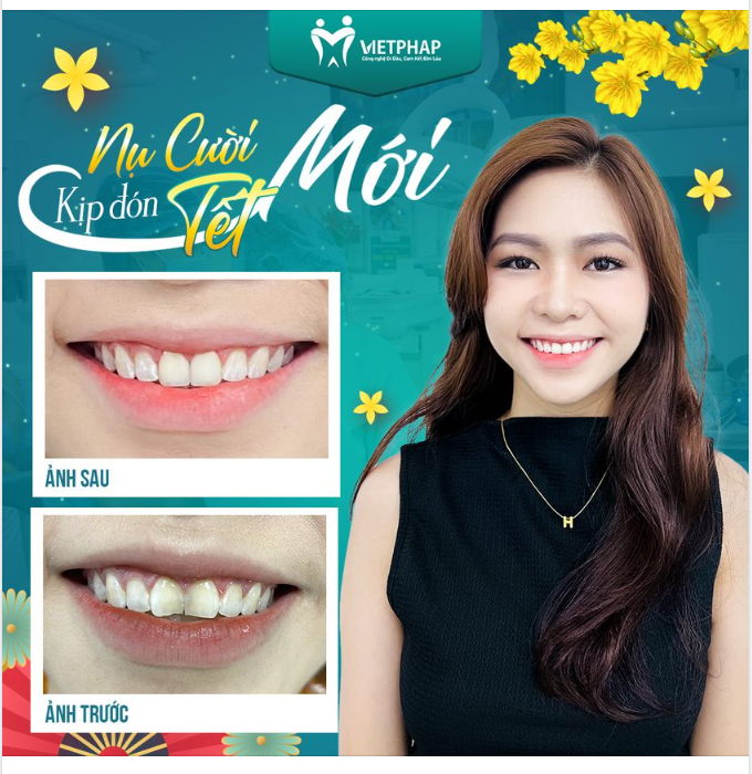 THAY RĂNG CỬA CŨ – ĐÓN TẾT NĂM MỚI