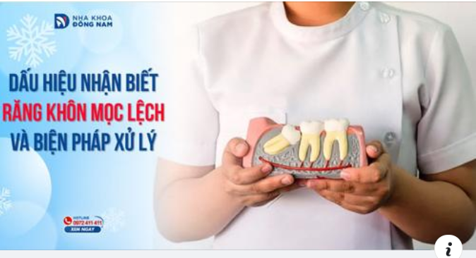 CÁC TRIỆU CHỨNG ĐIỂN HÌNH DƯỚI ĐÂY CHO THẤY BẠN CÓ RĂNG KHÔN MỌC LỆCH VÀ NÓ CÓ THỂ ĐAU NHỨC BẤT CỨ LÚC NÀO TRONG DỊP TẾT