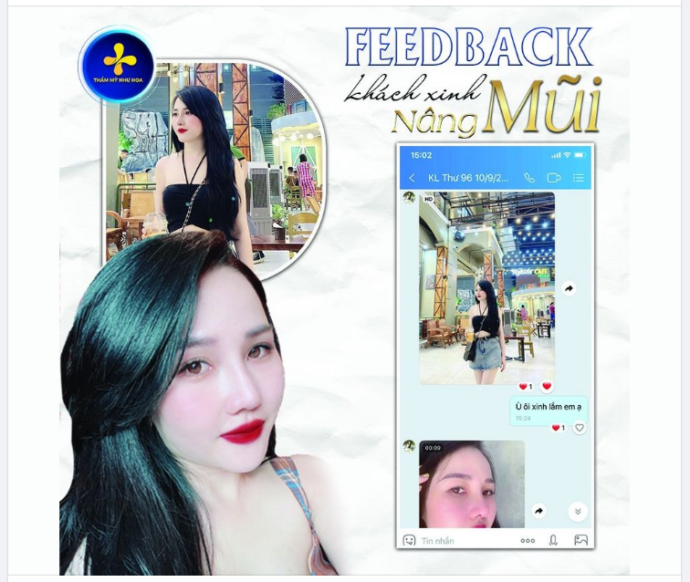 Feedback khách hàng nâng mũi tại Dr. Tống Hải - Thẩm mỹ Như Hoa