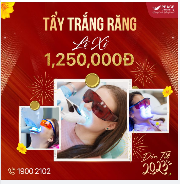 Khách hàng sẽ được so sánh màu răng trước & sau khi tẩy trắng để thấy rõ hiệu quả;