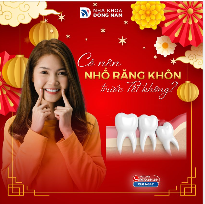 CÓ NÊN NHỔ RĂNG KHÔN TRƯỚC TẾT KHÔNG