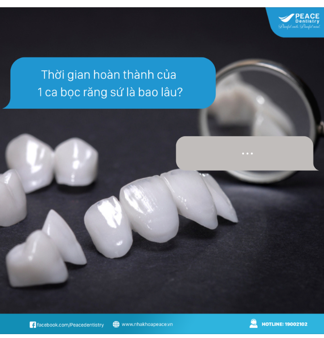 Tôi đang có ý định bọc răng sứ, bác sĩ cho tôi hỏi thời gian hoàn thành của 1 ca làm sứ là bao lâu vậy ạ?