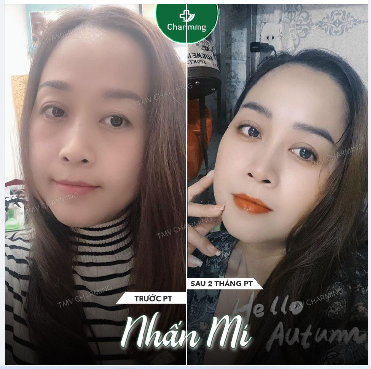 Lại là một chiếc feedback để tiếp thêm động lực làm đẹp cho mọi người đây
