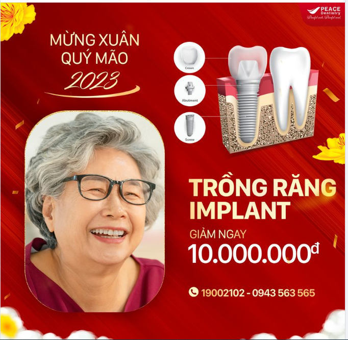 CÙNG BÁC SĨ CHUYÊN GIA & NHẬN ƯU ĐÃI ĐẶC BIỆT TẠI PEACE DENTISTRY