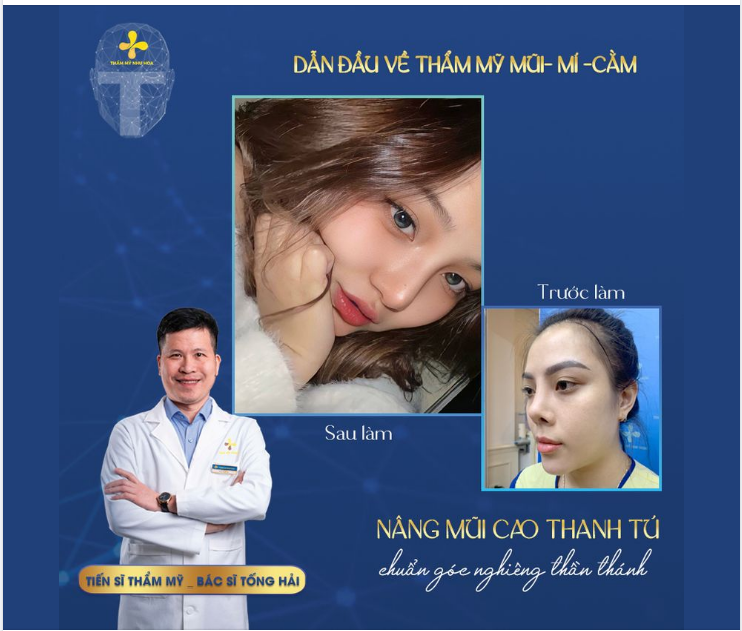 MŨI CAO SANG – TẠO GÓC NGHIÊNG THẦN THÁNH