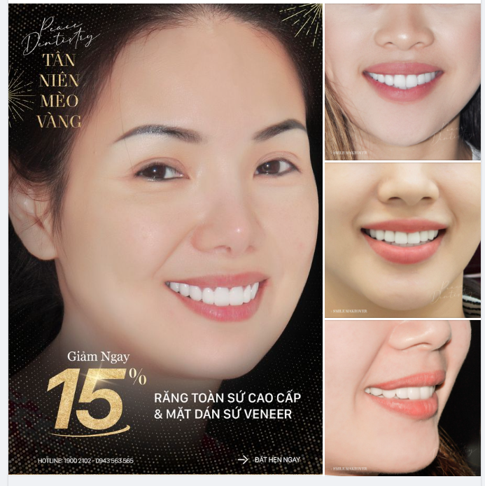 NÂNG TẦM NỤ CƯỜI MỪNG TÂN NIÊN MAY MẮN