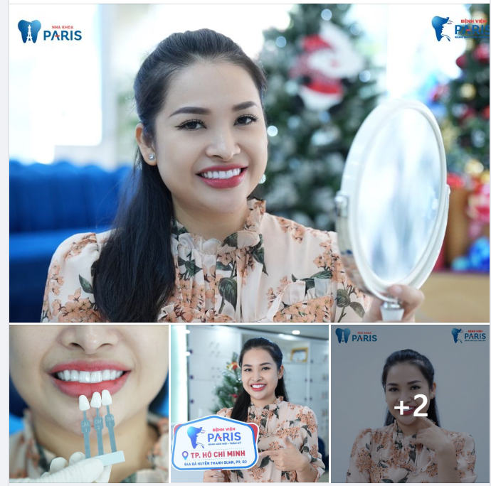 “Tết này đã khác Tết xưa, răng đẹp rước lộc, nhận ngàn ưu đãi"