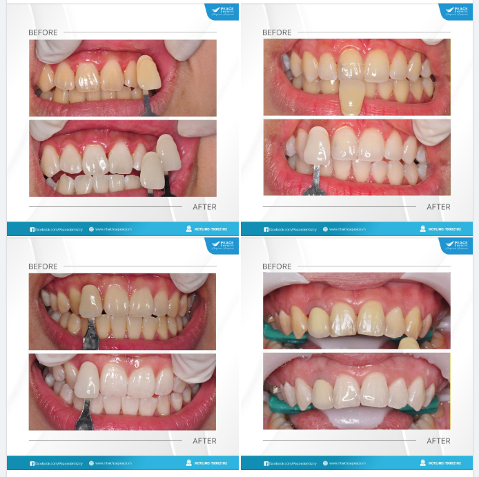 MỘT NỤ CƯỜI TOẢ SÁNG RẠNG RỠ